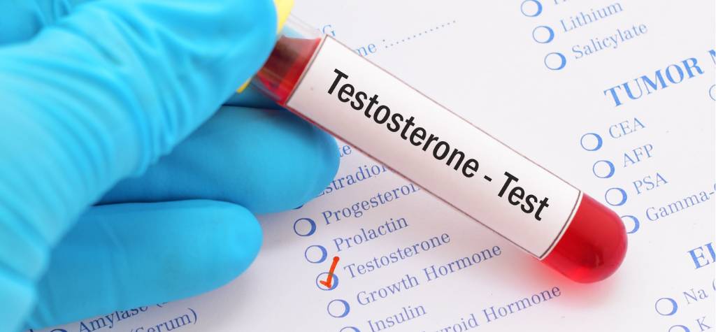 a Testosterone blood test