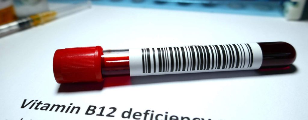 B12 Deficiency B12 Deficiency