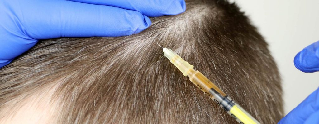 Biotin Hair Thinning Biotin Hair Thinning